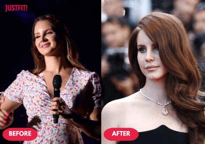 lana del rey weight loss